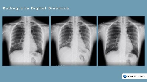 Radiografia Digital Dinâmica