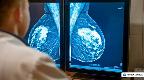 Mamografia Pandemia